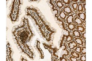 ABIN6263803 and ABIN6272971 at 1/100 staining Rat colon tissue by IHC-P.