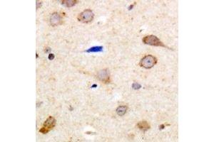 Immunohistochemical analysis of EDG5 staining in human brain formalin fixed paraffin embedded tissue section. (S1PR2 抗体  (C-Term))