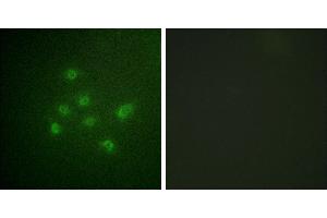 P-peptide - +Western blot analysis of extracts from HuvEc cells, using DAPK3 (Phospho-Thr265) antibody.