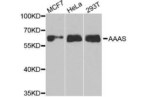 Western blot analysis of extracts of various cell lines, using AAAS antibody. (Adracalin 抗体)