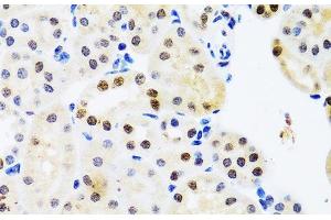 Immunohistochemistry of paraffin-embedded Mouse kidney using SET Polyclonal Antibody at dilution of 1:100 (40x lens). (SET/TAF-I 抗体)