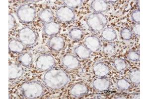 Image no. 1 for anti-Hematopoietic Cell-Specific Lyn Substrate 1 (HCLS1) (AA 266-356) antibody (ABIN598725) (HCLS1 抗体  (AA 266-356))