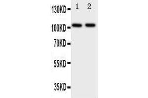 Anti-Zonula occludens protein 3 antibody, Western blotting Lane 1: Rat Brain Tissue Lysate Lane 2: Rat Heart Tissue Lysate (TJP3 抗体  (C-Term))