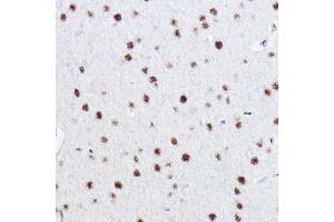 Immunohistochemistry of paraffin-embedded rat brain using p73 Rabbit mAb (ABIN1678945, ABIN1678944, ABIN7101487 and ABIN7101488) at dilution of 1:100 (40x lens). (Tumor Protein p73 抗体)