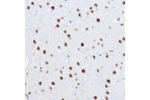 Immunohistochemistry of paraffin-embedded rat brain using p73 Rabbit mAb (ABIN1678945, ABIN1678944, ABIN7101487 and ABIN7101488) at dilution of 1:100 (40x lens). (Tumor Protein p73 抗体)