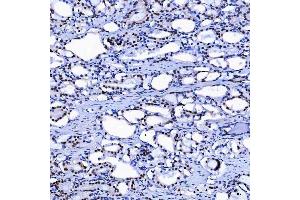 IHC analysis of SF3A1 using anti-SF3A1 antibody (ABIN7600556). (SF3A1 抗体  (AA 20-556))