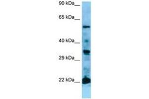 Image no. 1 for anti-GTPase NRas (NRAS) (AA 91-140) antibody (ABIN6749779) (GTPase NRas 抗体  (AA 91-140))