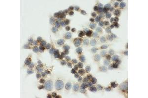ICC testing of IGF2R antibody and HCT116 cells (IGF2R 抗体  (C-Term))
