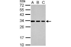 WB Image Sample (30 ug of whole cell lysate) A: 293T B: A431 C: HeLa 12% SDS PAGE antibody diluted at 1:1000 (Tetraspanin 3 抗体)