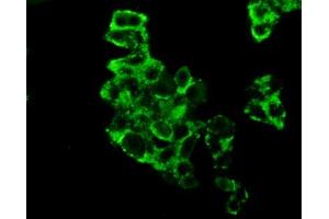 Figure:FITC staining on IHC-P Simple: Mcf7 cells