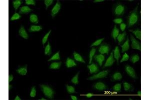 Immunofluorescence of monoclonal antibody to MTAP on HeLa cell. (MTAP 抗体  (AA 1-154))