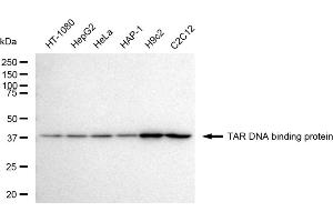 Western blotting analysis using TAR DNA binding protein antibody (ABIN7800512).