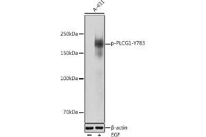 Western blot analysis of extracts of A-431 cells, using Phospho-PLC gamma 1 (PLCG1)-Y783 antibody (ABIN3019685, ABIN3019686, ABIN3019687 and ABIN1681934) at 1:1000 dilution. (Phospholipase C gamma 1 抗体  (pTyr783))