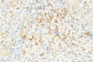 Immunohistochemistry analysis of paraffin-embedded rat ovary using,NRK (ABIN7074842) at dilution of 1: 1500 (NRK 抗体)