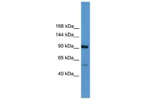 WB Suggested Anti-LPA Antibody Titration: 0. (LPA 抗体  (Middle Region))
