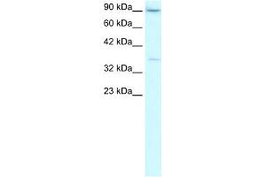WB Suggested Anti-TBP Antibody Titration:  2. (TBP 抗体  (Middle Region))