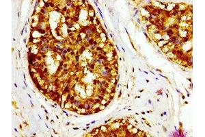 Immunohistochemistry (IHC) image for anti-Macrophage Migration Inhibitory Factor (Glycosylation-Inhibiting Factor) (MIF) (AA 2-115) antibody (ABIN7158882)
