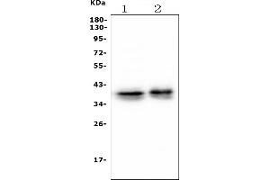 Western blot analysis of MSI using anti-MSI antibody (ABIN7603130).