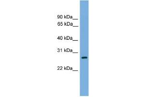 WB Suggested Anti-ATPAF1 Antibody Titration: 0. (ATPAF1 抗体  (N-Term))