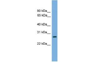 WB Suggested Anti-ATPAF1 Antibody Titration: 0.
