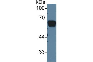 Western Blot; Sample: Rat Serum; Primary Ab: 1µg/ml Rabbit Anti-Rat AGT Antibody Second Ab: 0. (AGT 抗体  (AA 25-477))