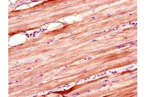 Immunohistochemistry of paraffin-embedded human skeletal muscle tissue using ABIN7176655 at dilution of 1:100 (ZSWIM6 抗体  (AA 430-583))