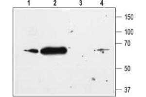 Western blot analysis of rat heart (lanes 1 and 3) and rat brain (lanes 2 and 4) membranes: - 1,2.
