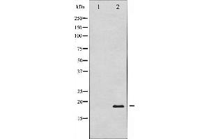 Western blot analysis of Pin1 expression in COS7 whole cell lysates,The lane on the left is treated with the antigen-specific peptide. (PIN1 抗体)