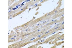 Immunohistochemistry of paraffin-embedded Rat heart using NSF Polyclonal Antibody at dilution of 1:100 (40x lens). (NSF 抗体)