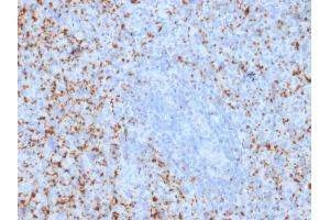 Formalin-fixed, paraffin-embedded human Spleen stained with CD61 Mouse Monoclonal Antibody (ITGB3/2145). (Integrin beta 3 抗体  (AA 385-490))