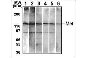 Western Blotting (WB) image for anti-Met Proto-Oncogene (MET) (pTyr1234), (pTyr1235) antibody (ABIN356338)