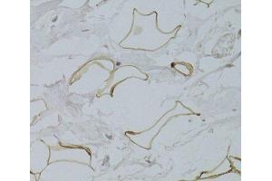 Immunohistochemistry of paraffin-embedded Human breast adipocytes using GPD1 Polyclonal Antibody at dilution of 1:100 (40x lens). (GPD1 抗体)