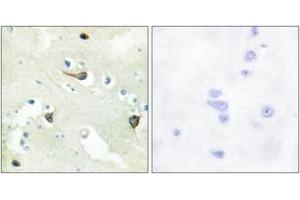 Immunohistochemistry analysis of paraffin-embedded human brain tissue, using EPHB1/2/3 Antibody. (EPH Receptor B1/2/3 (AA 631-680) 抗体)