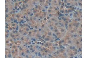 Detection of IGFBP5 in Mouse Kidney Tissue using Polyclonal Antibody to Insulin Like Growth Factor Binding Protein 5 (IGFBP5) (IGFBP5 抗体  (AA 25-271))