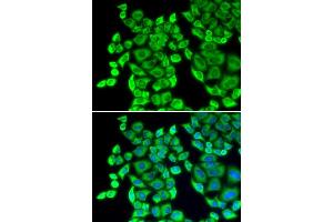 Immunofluorescence (IF) image for anti-Eukaryotic Translation Elongation Factor 1 delta (Guanine Nucleotide Exchange Protein) (EEF1D) antibody (ABIN1872432) (EEF1D 抗体)