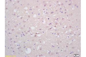 Immunohistochemistry (IHC) image for anti-Paired Box 6 (PAX6) (AA 51-150) antibody (ABIN1387454)