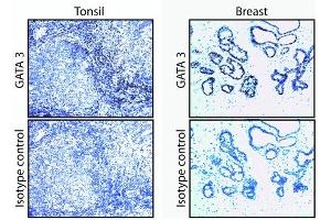 Immunohistochemistry (IHC) image for anti-GATA Binding Protein 3 (GATA3) antibody (ABIN967621) (GATA3 抗体)
