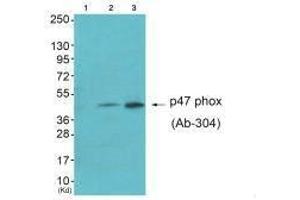 Western blot analysis of extracts from HepG2 cells (Lane 2) and Jurket cells (Lane 3), using Neutrophil Cytosol Factor 1 (Ab-304) antiobdy. (NCF1 抗体  (Ser304))
