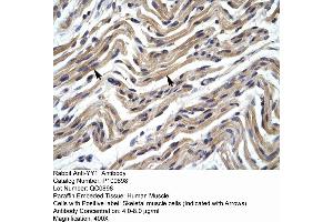 Human Muscle (YY1 抗体  (Middle Region))