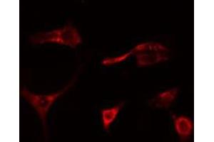 ABIN6278655 staining Hela cells by IF/ICC. (MAP3K1 抗体  (pThr1402))