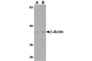 Image no. 1 for anti-Actin, beta (ACTB) (C-Term) antibody (ABIN341734) (beta Actin 抗体  (C-Term))