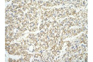 Rabbit Anti-LSM4 antibody   Paraffin Embedded Tissue: Human Heart cell Cellular Data: cardiac cell of renal tubule Antibody Concentration: 4. (LSM4 抗体  (Middle Region))