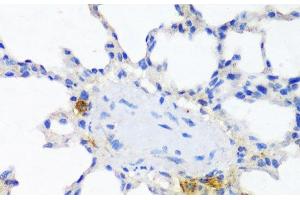 Immunohistochemistry of paraffin-embedded Rat lung using ITGAX Polyclonal Antibody at dilution of 1:100 (40x lens). (CD11c 抗体)