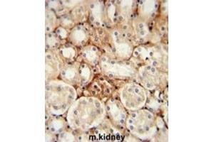 Immunohistochemistry (IHC) image for anti-ATP Synthase, H+ Transporting, Mitochondrial Fo Complex, Subunit J2 (ATP5J2) antibody (ABIN3002313) (ATP5J2 抗体)