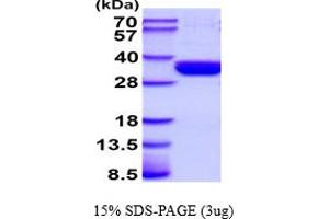 SDS-PAGE (SDS) image for CD207 Molecule, Langerin (CD207) (AA 65-328) protein (His tag) (ABIN5854553) (CD207 Protein (AA 65-328) (His tag))