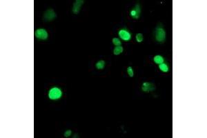 Anti-METT10D mouse monoclonal antibody (ABIN2455777) immunofluorescent staining of COS7 cells transiently transfected by pCMV6-ENTRY METT10D (RC208648). (METTL16 抗体)