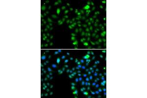 Immunofluorescence analysis of MCF-7 cells using ING5 antibody. (ING5 抗体  (AA 1-220))