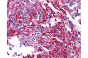 Immunohistochemistry (IHC) image for anti-Corticotropin Releasing Hormone Receptor 1 (CRHR1) (N-Term) antibody (ABIN1048463)