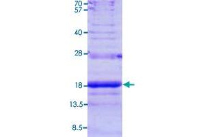 Image no. 1 for Small Nuclear Ribonucleoprotein D3 Polypeptide 18kDa (SNRPD3) (AA 1-126) protein (His tag) (ABIN5570372)