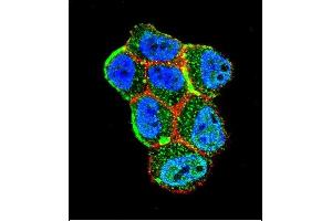 Confocal immunofluorescent analysis of STK11 (LKB1) Antibody (N-term I29) (ABIN391350 and ABIN2841371) with ZR-75-1 cell followed by Alexa Fluor 488-conjugated goat anti-rabbit lgG (green). (LKB1 抗体  (N-Term))
